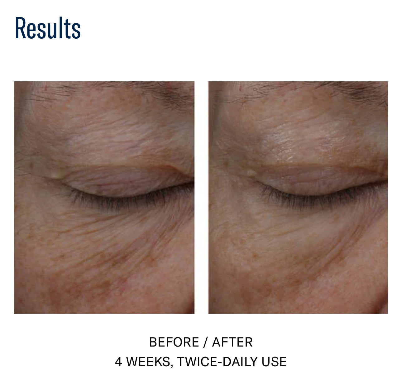 Skinbetter Science Interfuse Treatment EYES