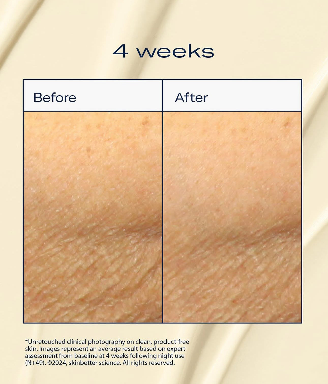 Skinbetter Science AlphaRet Body Overnight Cream