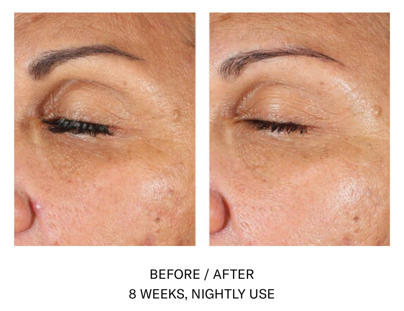 Skinbetter Science AlphaRet EyeMax