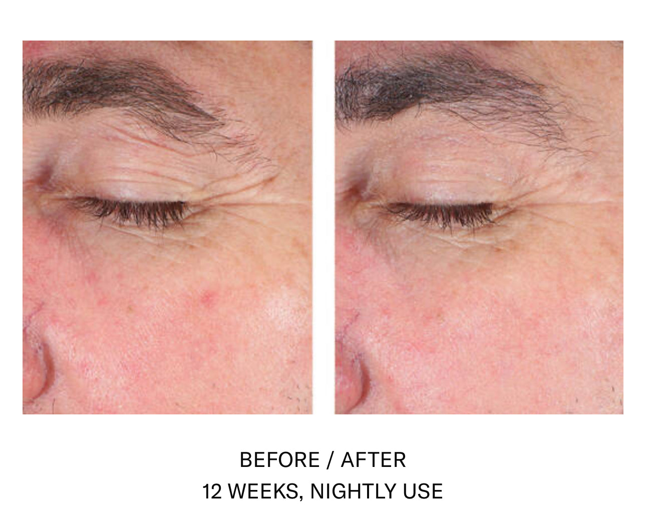 Skinbetter Science AlphaRet EyeMax