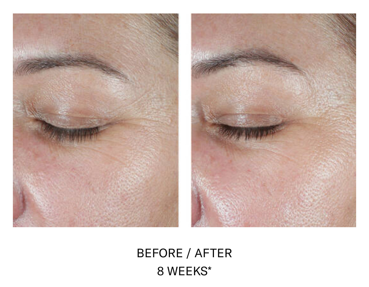 Skinbetter Science AlphaRet EyeMax