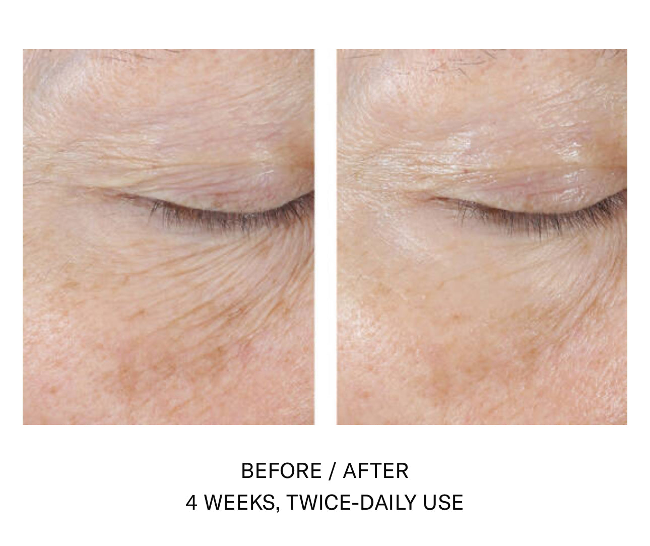 Skinbetter Science Interfuse Treatment EYES