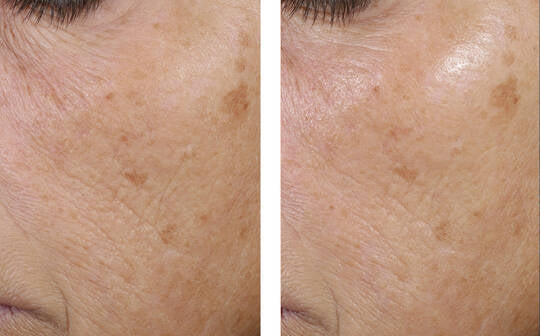 Skinbetter Science Trio Rebalancing Moisturizer