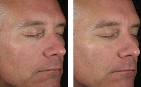 Skinbetter Science Solo Hydrating Defense MEN
