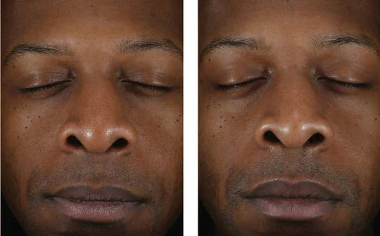 Skinbetter Science Solo Hydrating Defense MEN