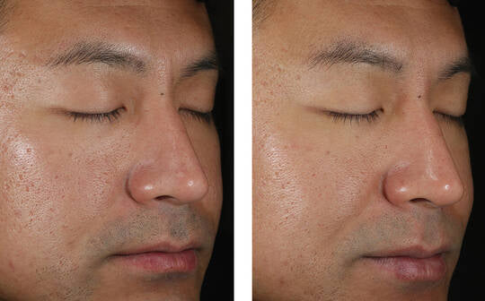 Skinbetter Science Solo Hydrating Defense MEN