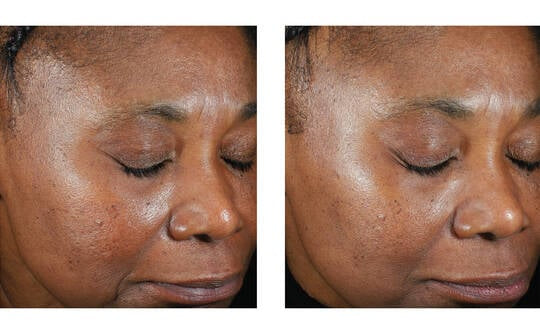 Skinbetter Science Trio Luxe Moisturizer