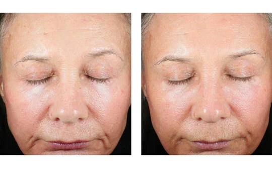 Skinbetter Science Trio Luxe Moisturizer