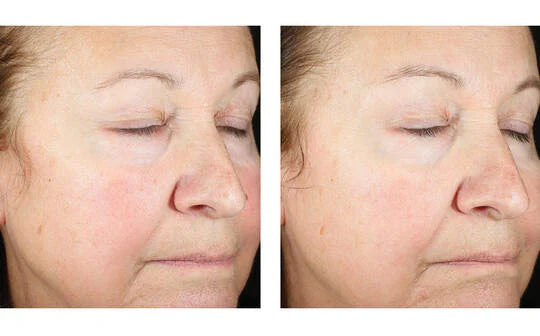 Skinbetter Science Trio Luxe Moisturizer