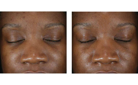 Skinbetter Science Clarity Regimen