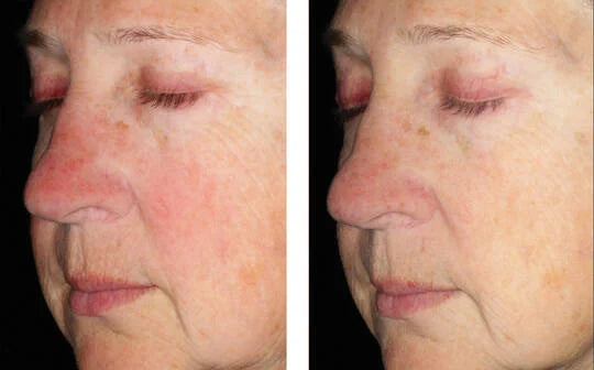 Skinbetter Science Alto Defense Serum