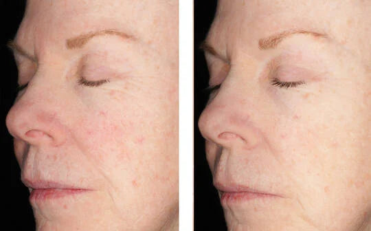 Skinbetter Science Alto Defense Serum