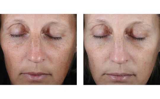 Skinbetter Science Even Glow Regimen