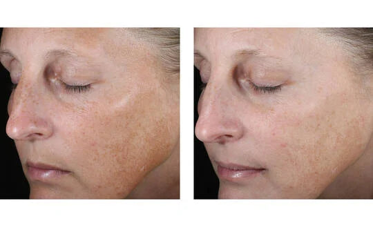 Skinbetter Science Even Glow Regimen
