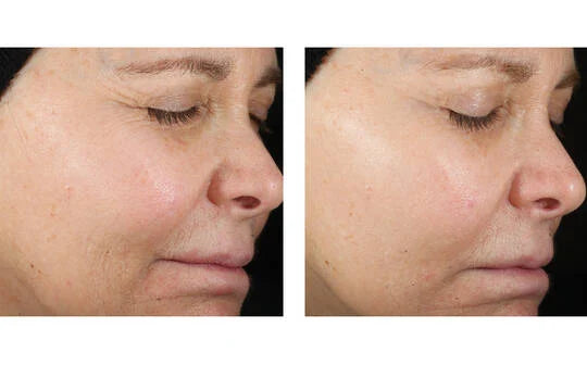 Skinbetter Science Even Glow Regimen
