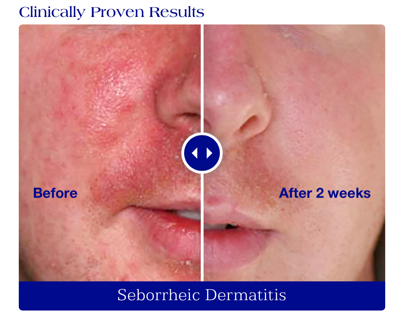 Is Clinical Pro-Heal Serum Advance+