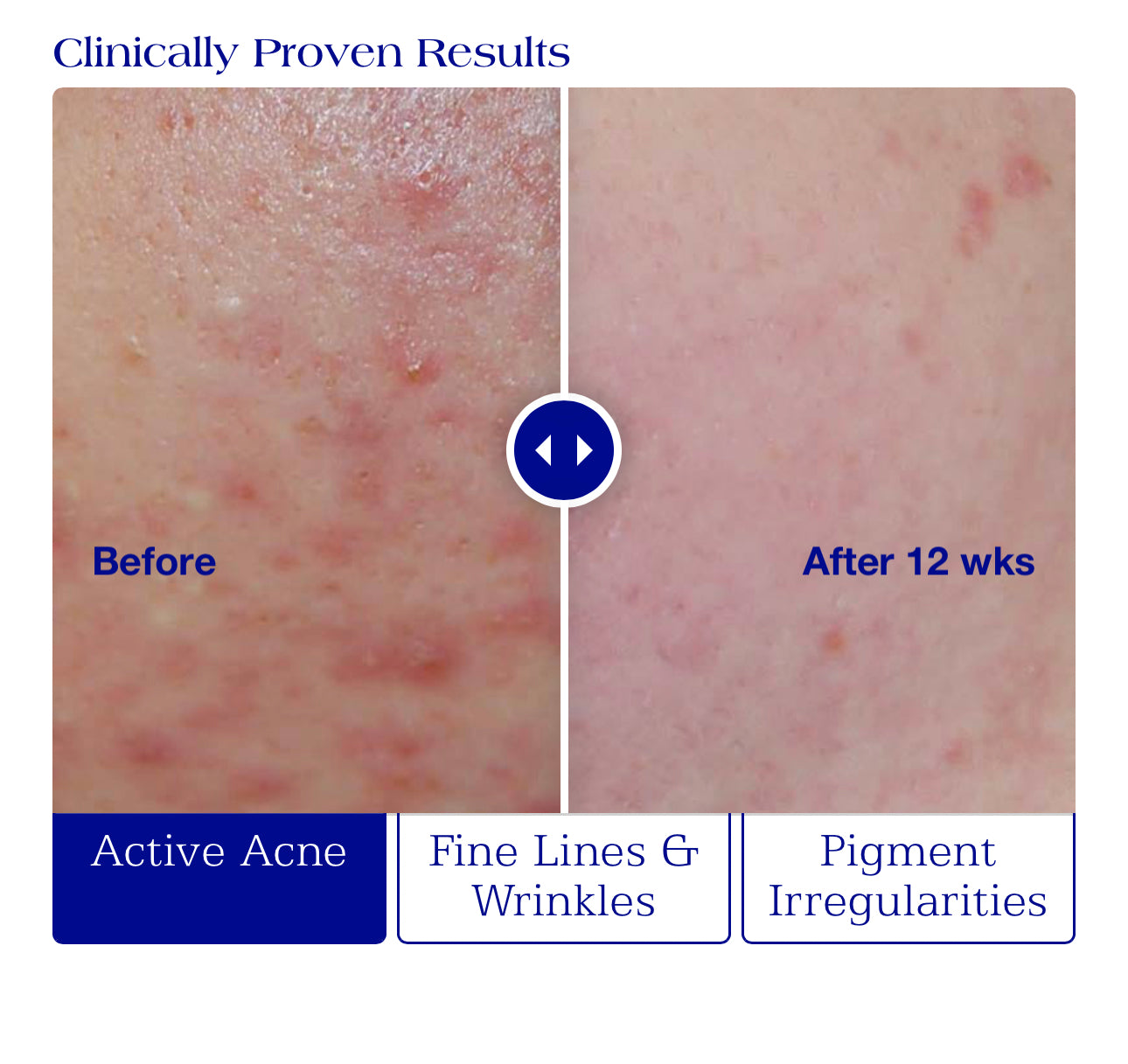 Active Serum